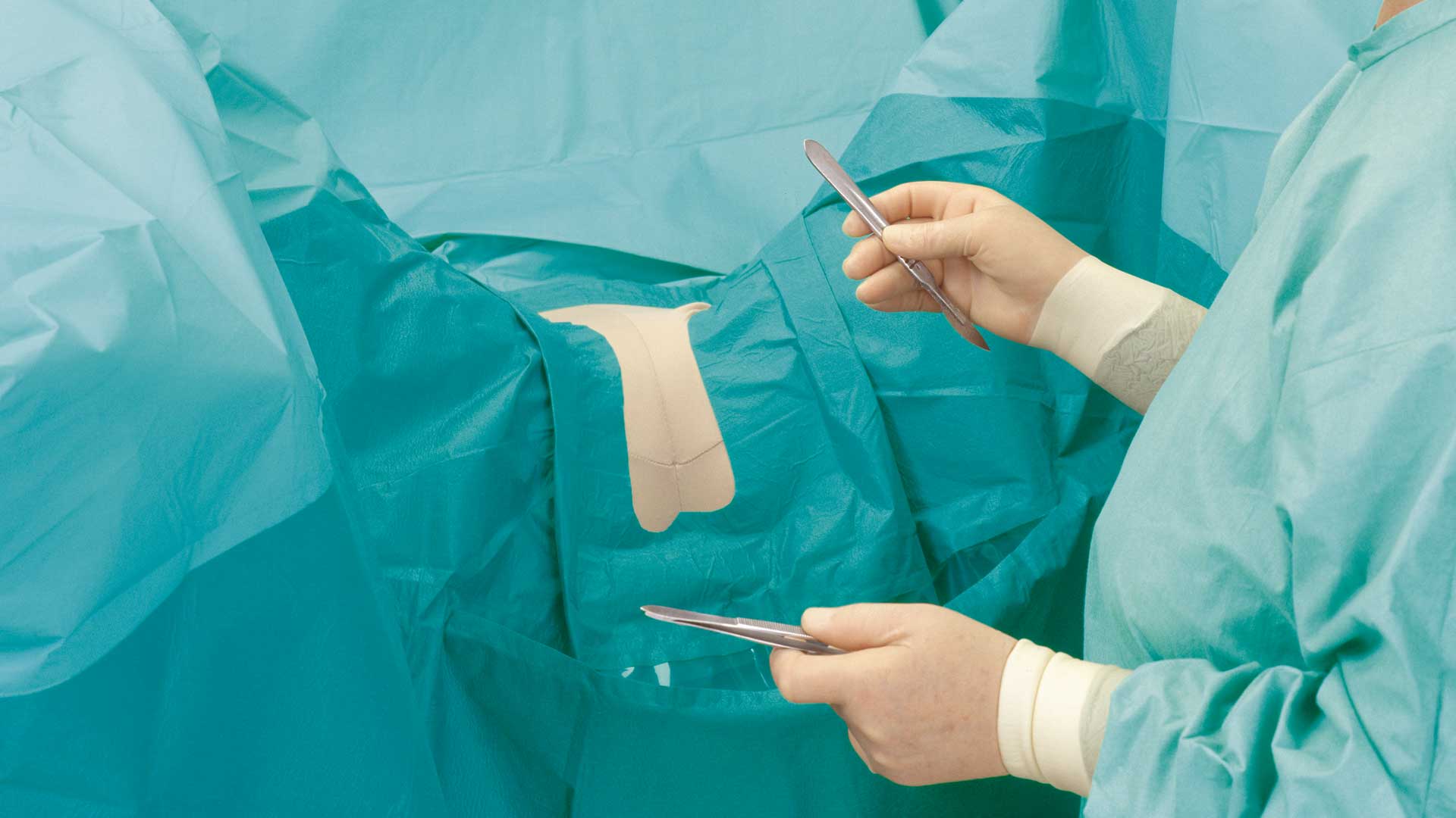 BARRIER nőgyógyászati lepedőt használó sebész műtét közben